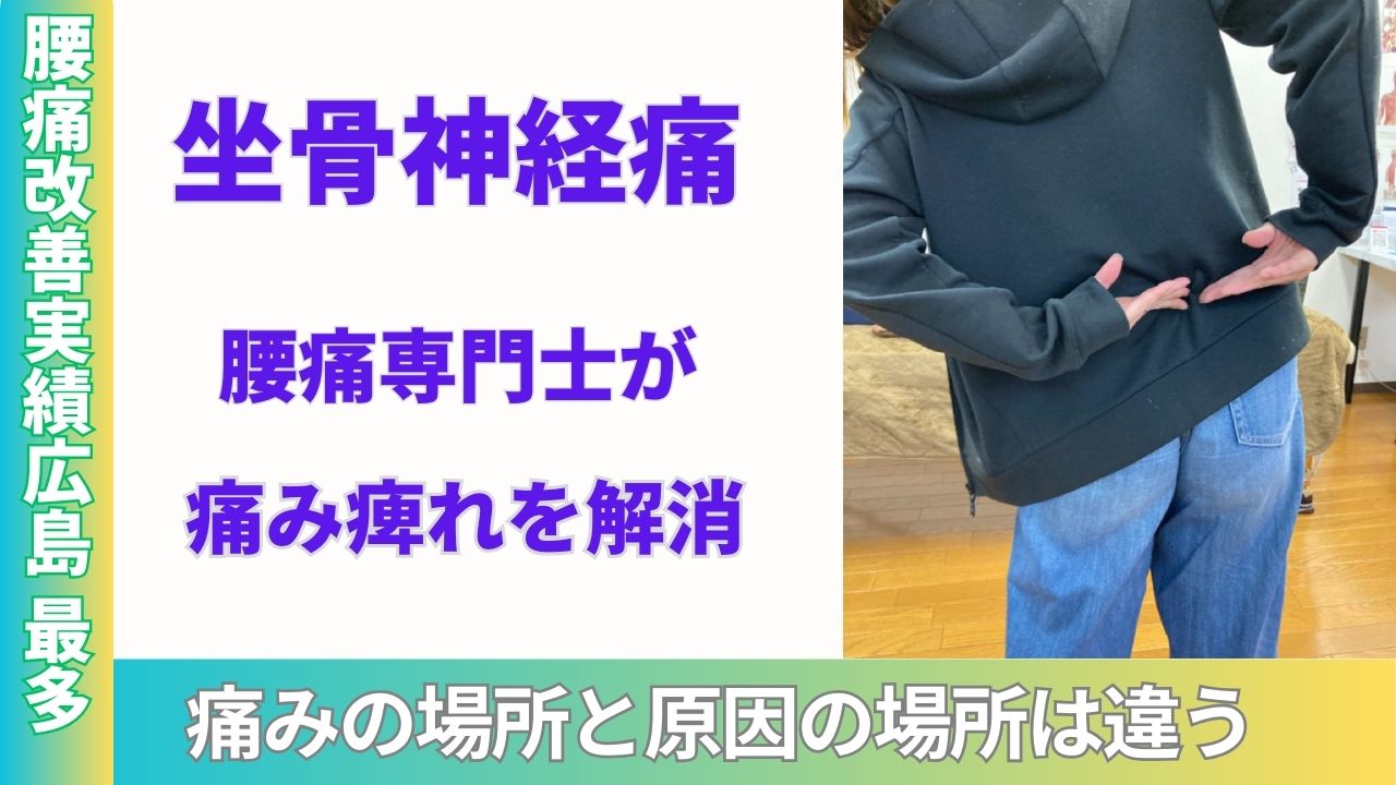 坐骨神経痛治療-広島で１番の改善実績の整体院