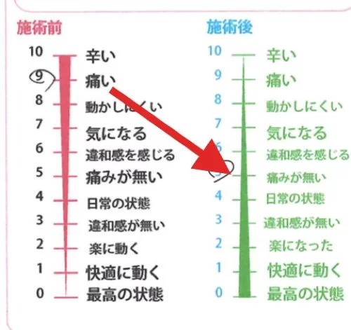 腰痛-ぎっくり腰の治療-整体改善例