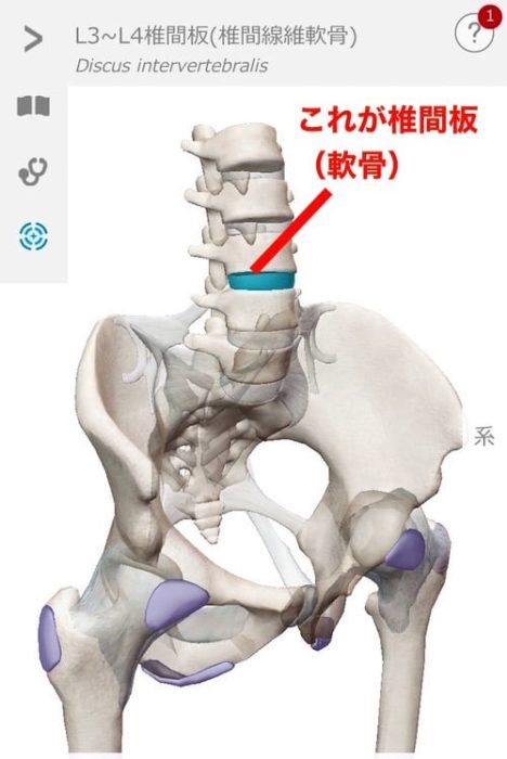 ヘルニアの原因解説１