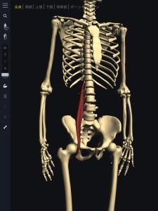 ヘルニア発症のメカニズム１