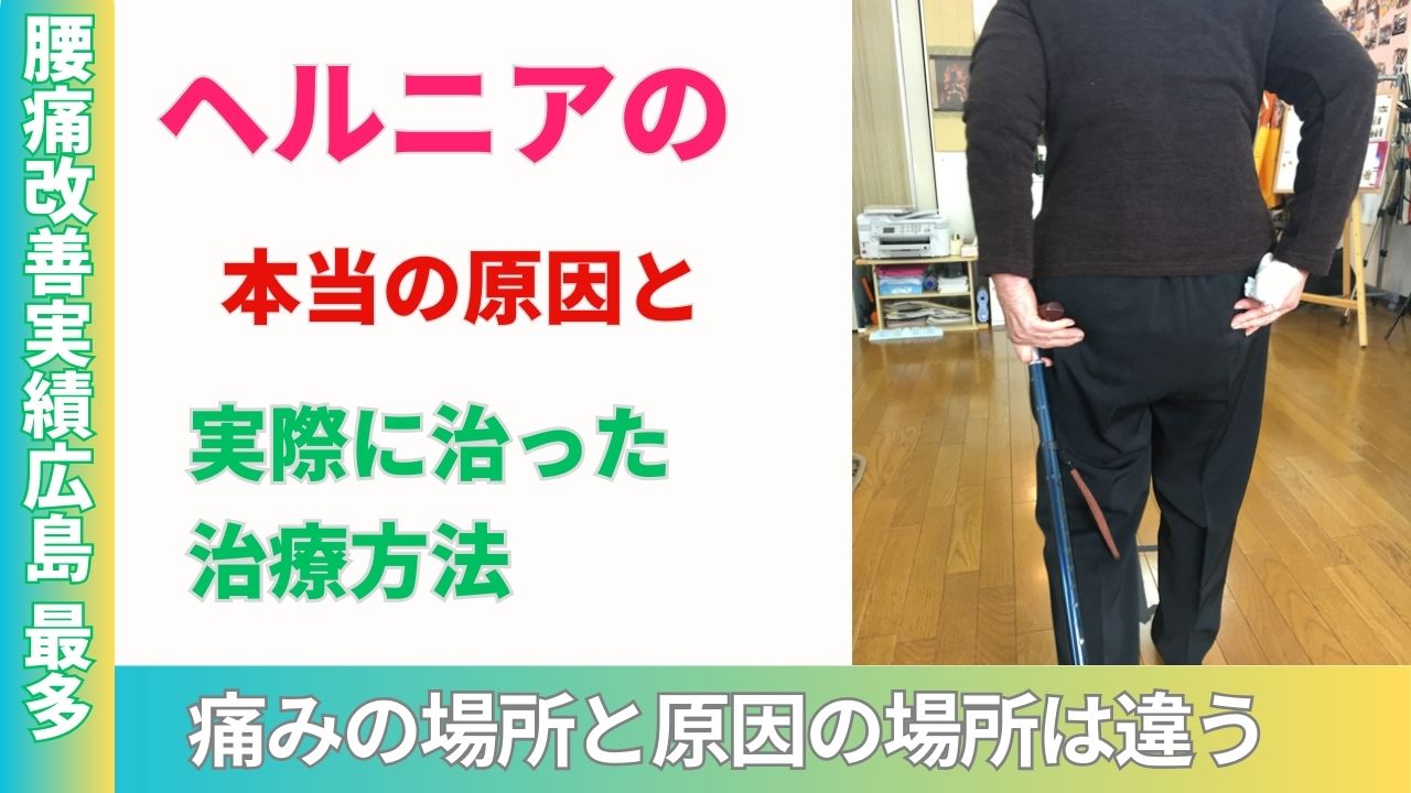 ヘルニアの本当の原因と実際に治った治療方法