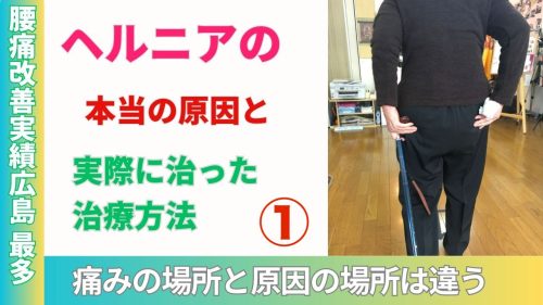 ヘルニアの本当の原因と実際に治った治療方法１