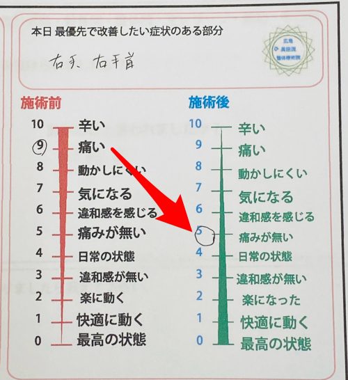 腱鞘炎の痛みが施術後に無くなった