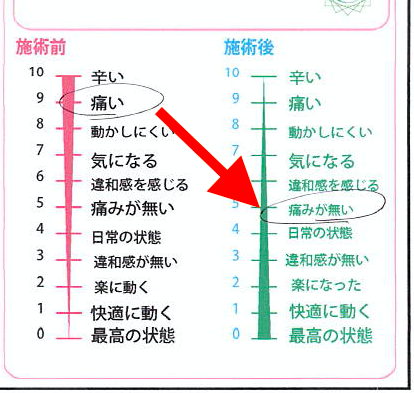 腰痛の痛みが無くなった