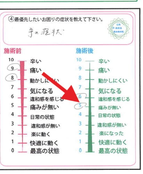 手の症状 痛みが無くなった図