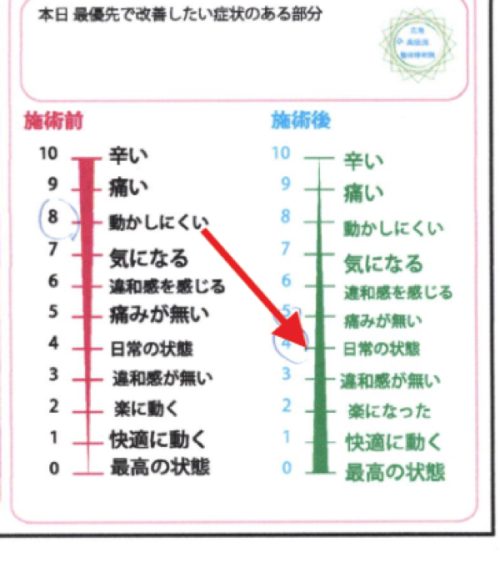 肩こりが楽になったグラフ