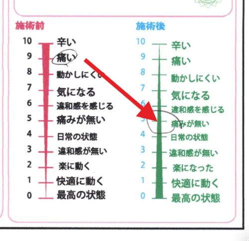 痛みが無くなった
