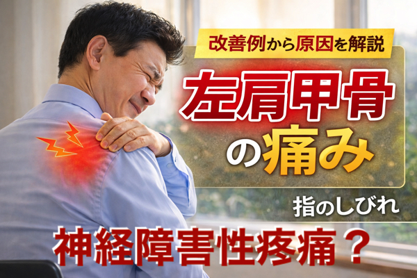 神経障害性疼痛