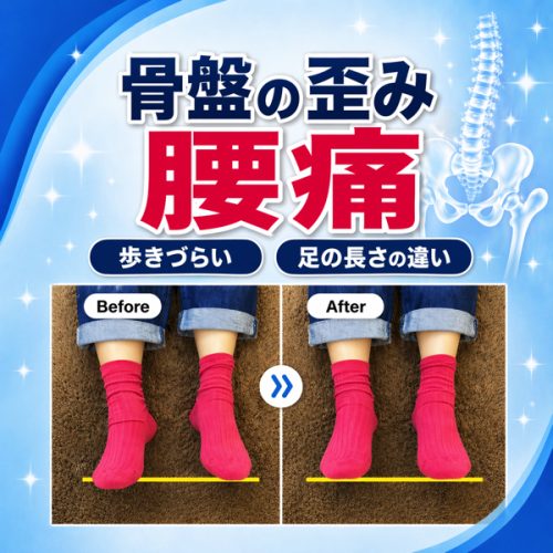 骨盤の歪みと腰痛＿タイトル