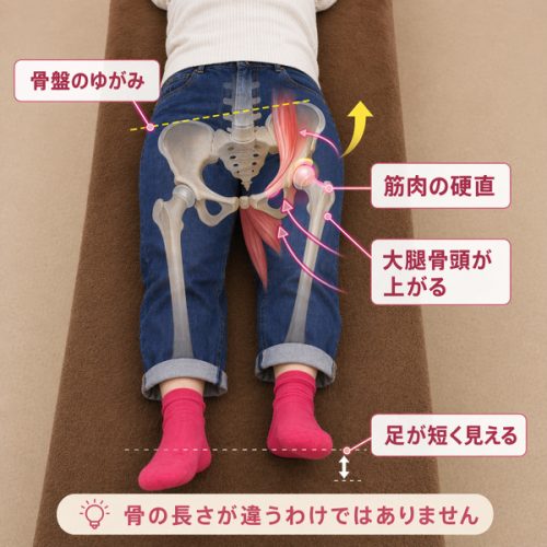 骨盤の歪みによる足の左右差ができるメカニズム