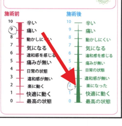 施術前後比較のペインスケール＿施術前＝痛い/施術後＝楽になった