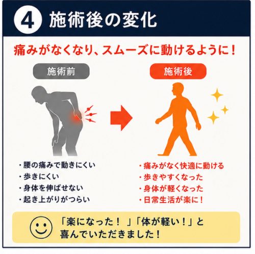 施術後は歩行もスムーズ