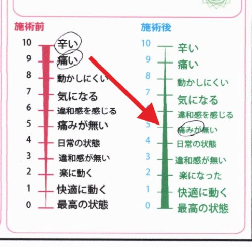 施術前後アンケート＿痛みが無くなった
