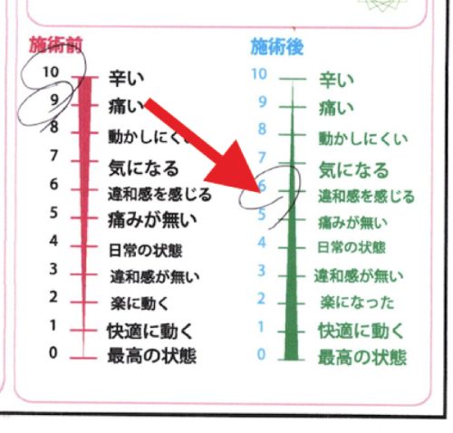 違和感程度になった